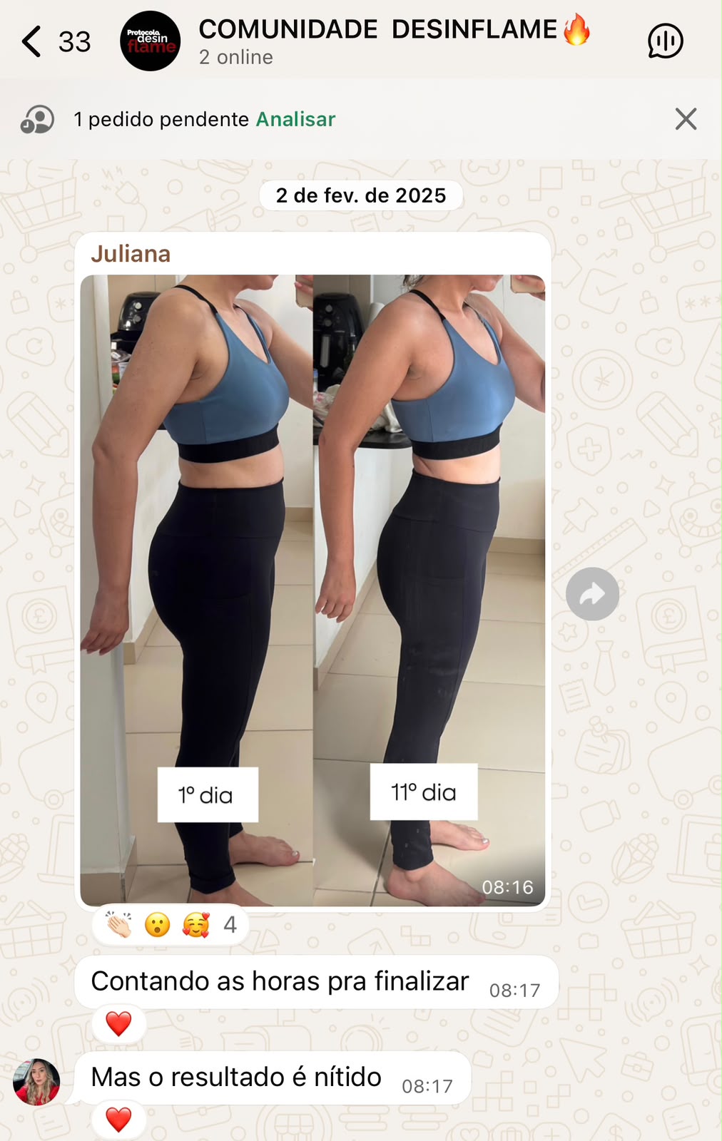 Foto antes e depois de Juliana no 1º e no 11º dia do protocolo